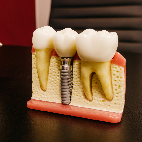 missing tooth