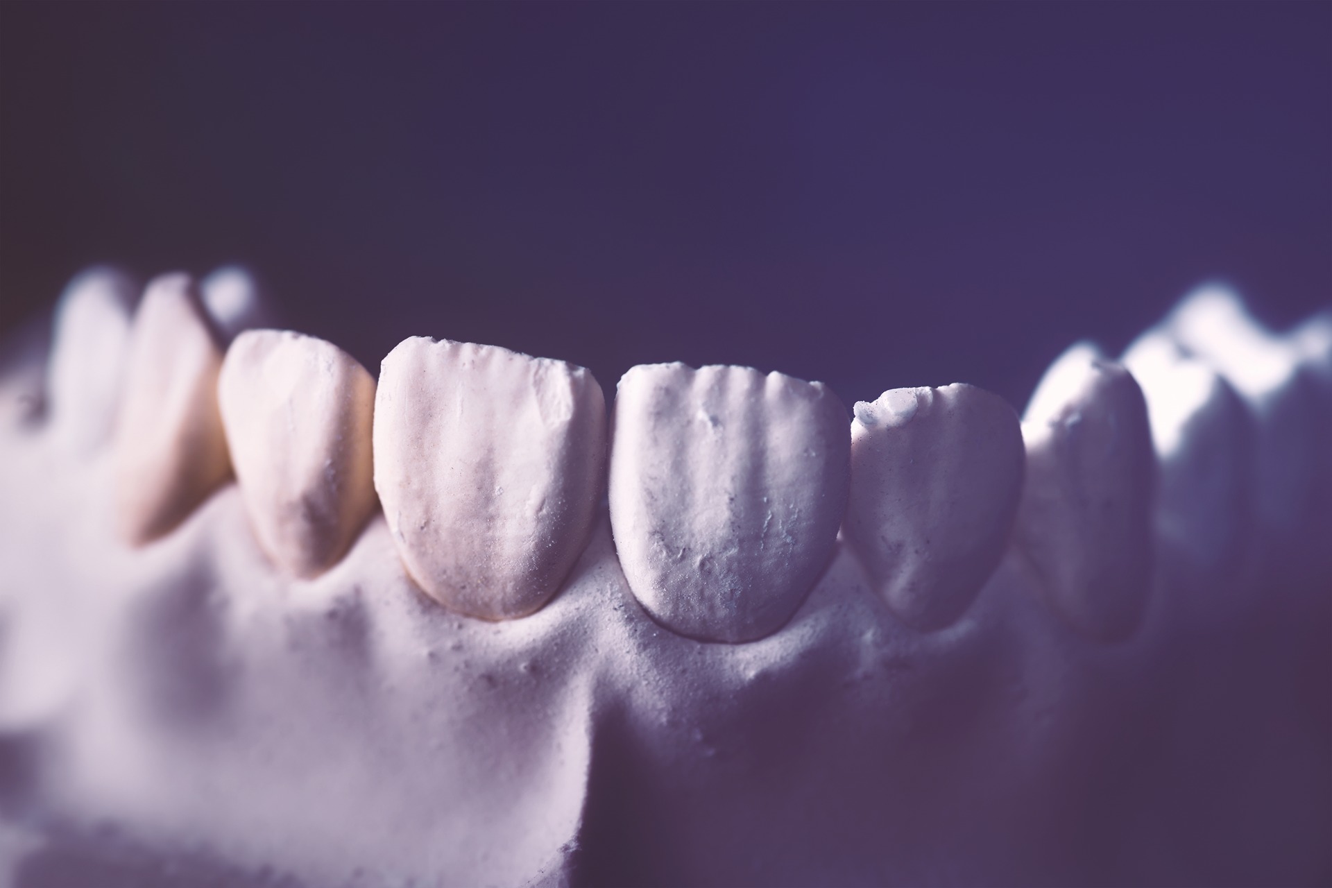 CAD/CAM dental restorations