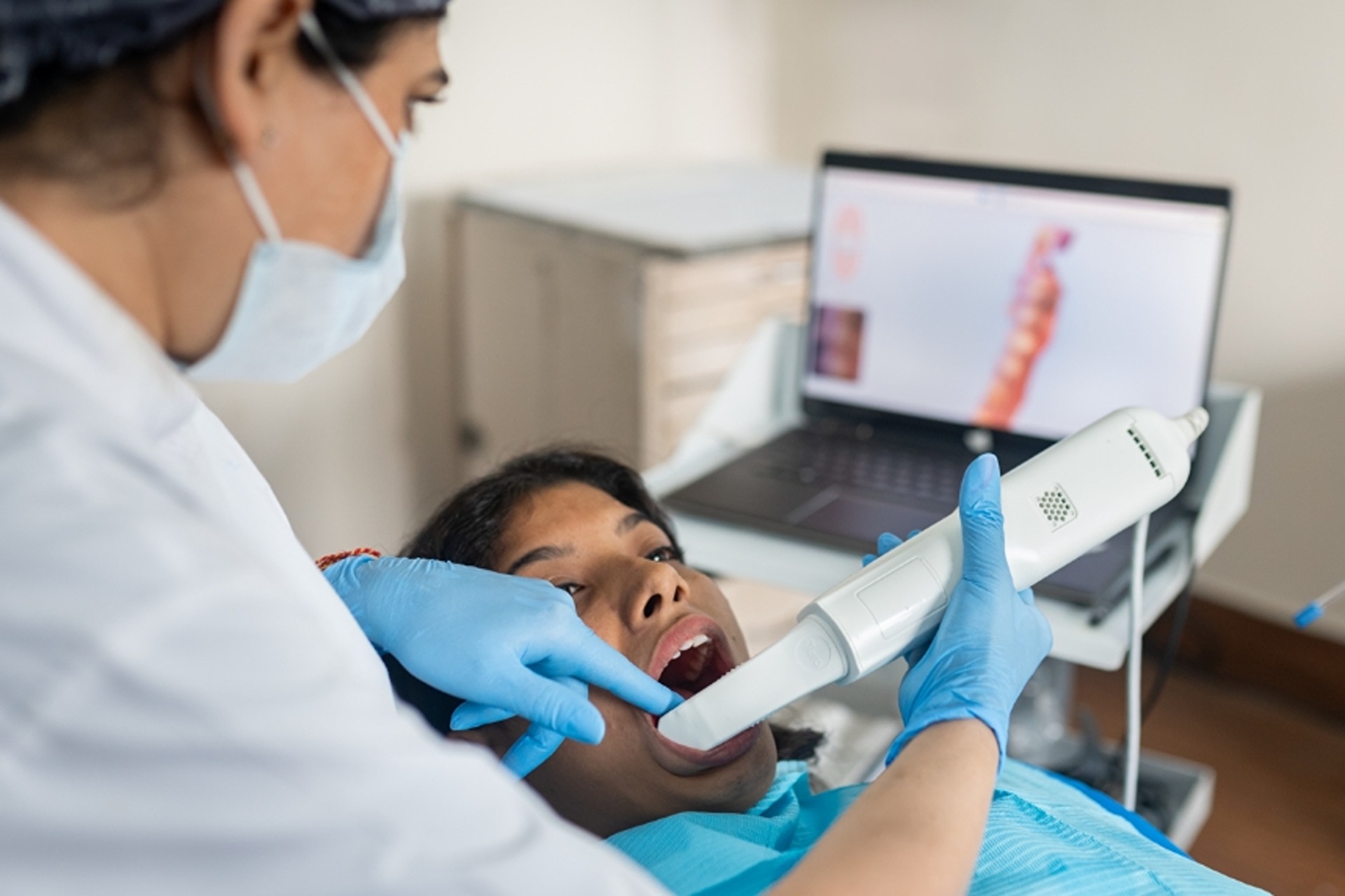 Intraoral Scanner